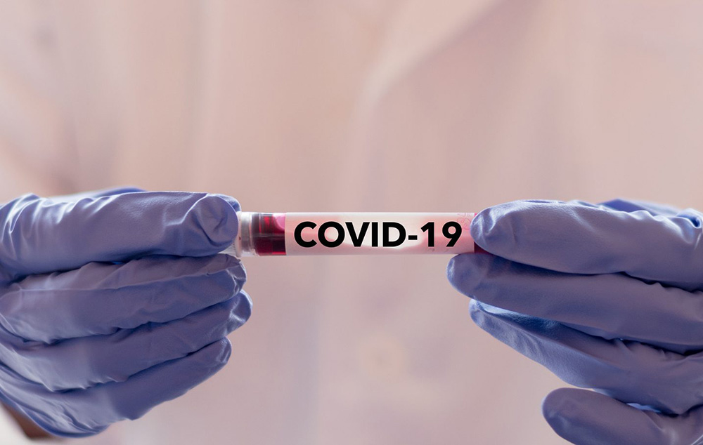How Healthcare Executives Are Responding to COVID-19 featured image