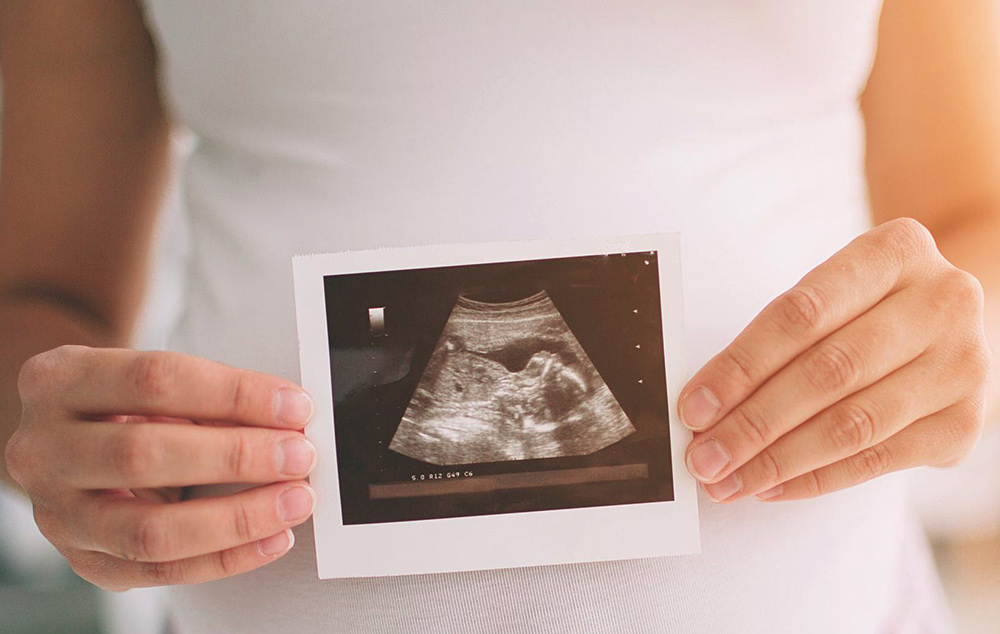 Coming Out of COVID, Fertility Services Remain Uniquely Strong featured image